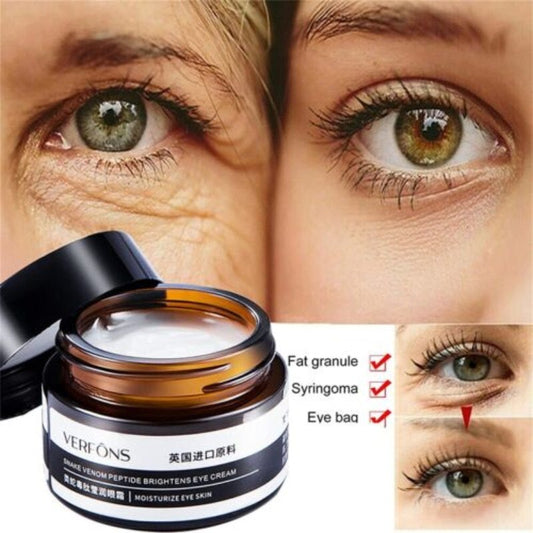 Ridules anneau pour les yeux soin des yeux hydratant Essence masque pour les yeux lait